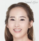 臉面輪廓整形前后照片
