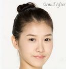 [高蘭得整形外科]臉部輪廓手術(shù) 前后照片2