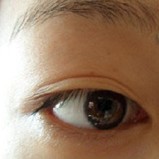 擺脫雙眼皮貼，看我的埋線雙眼皮效果如何