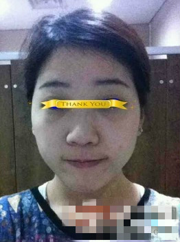 做了隆鼻，大家?guī)臀铱纯醋龅娜绾?></a>
                </div>
            </div>
            <a href=
