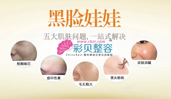 黑臉娃娃駕到 毛孔粗大byebye