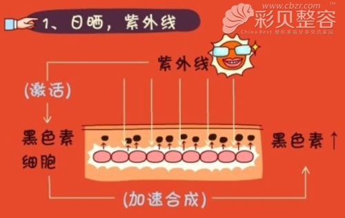 日曬
