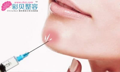 玻尿酸豐下巴為什么受歡迎 關(guān)鍵在這里