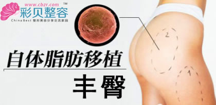 填充凹陷 自體脂肪豐臀讓體型凹凸有致