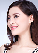 豐額頭整形案例