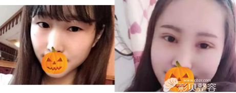 合肥壹加壹玖度美眼真人案例