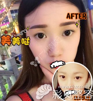 廣州韓妃紋繡王小斌紋眉案例效果對比圖