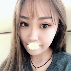 找蘇州康美整形劉道功割雙眼皮術(shù)后效果真心好,強(qiáng)力推薦！