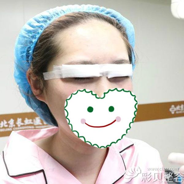 閨蜜到東莞壹加壹整形割雙眼皮術(shù)后第1天
