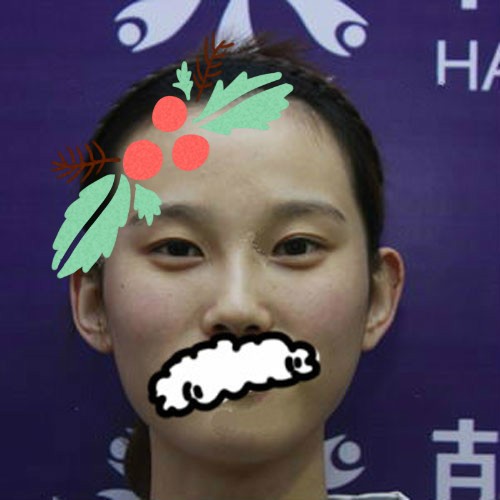 2年后埋線雙眼皮沒(méi)了，我又跑去聊城韓美割了雙眼皮+開(kāi)眼角