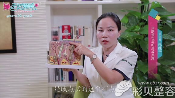 聽張繼平說皮膚損傷后的形成原理