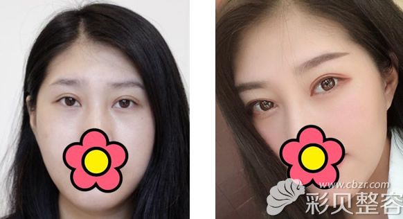 北京禾美嘉成燕燕韓式半 永 久紋眉第五天效果圖