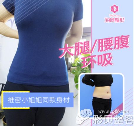 濟(jì)南海峽整形吸脂效果好不好