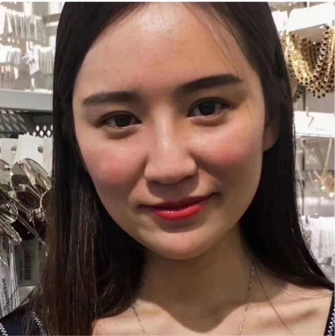 溫江美都整形給我自信