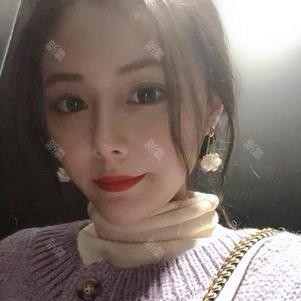 假體隆鼻+耳軟骨墊鼻尖