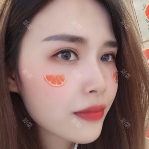 全切雙眼皮  找到黃金切割點(diǎn) 自然靈動(dòng)