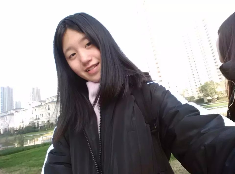 小平行雙眼皮