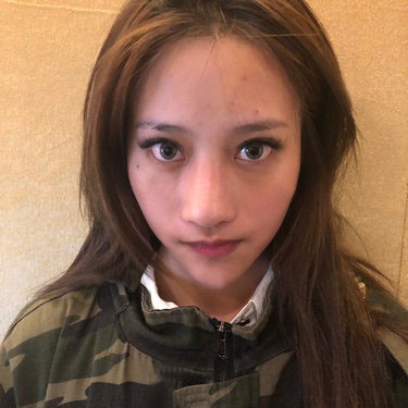 常德凱爾美斯硅膠隆鼻時間久,鼻子會變短?