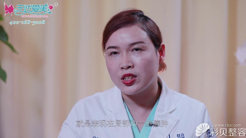 馬醫(yī)生講上瞼臃腫除了自身水腫之外眼側(cè)也會有局部臃腫