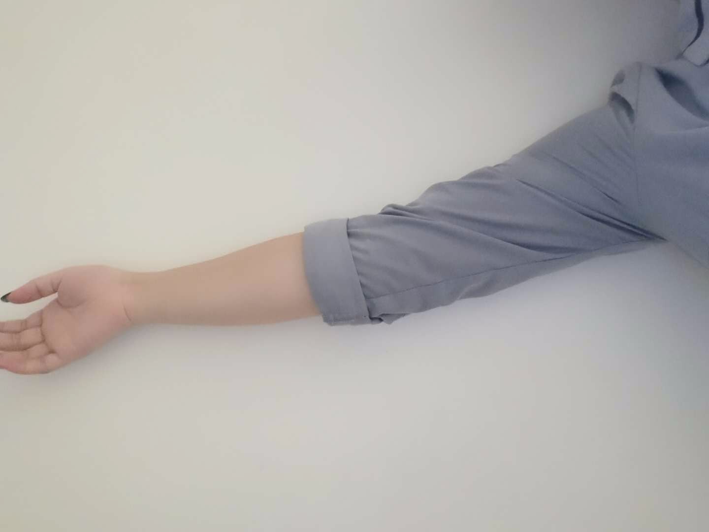 手臂吸脂告別拜拜肉蝴蝶臂