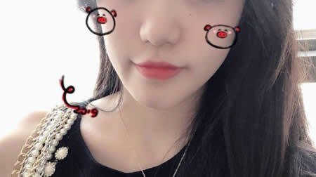 拜托大家來評價張家界依萊美為我做鼻頭鼻翼縮小效果如何
