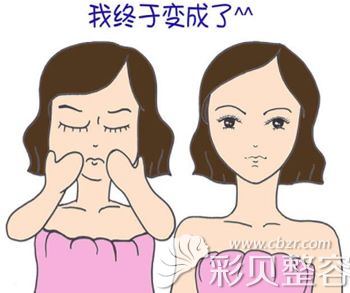 做輪廓整形前后對比卡通圖