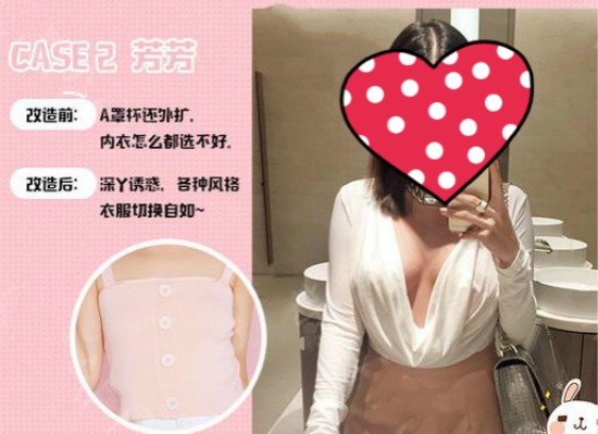 三個妹紙都說在福州愛美爾整形做曼托假體隆胸一點(diǎn)不后悔