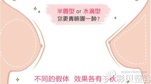 李如杰隆胸可以根據(jù)求美者需求選擇適合的假體形狀