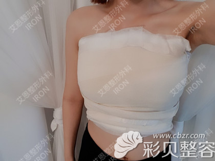 韓國艾恩假體隆胸術(shù)后3天