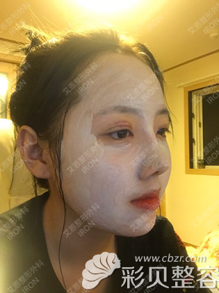 韓國艾恩金尹鎬鼻綜合改善駝峰鼻