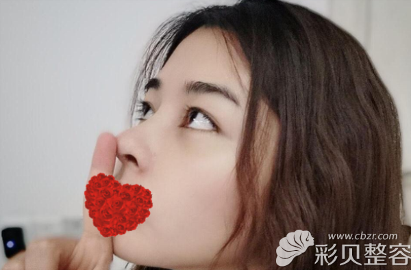硅膠隆鼻1個月疤痕不明顯