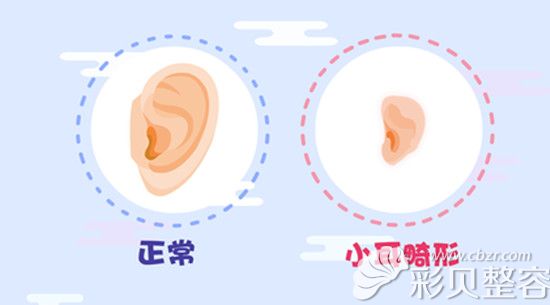 聽說去韓國可以治好4歲小男孩天生的耳朵畸形，是真是假？
