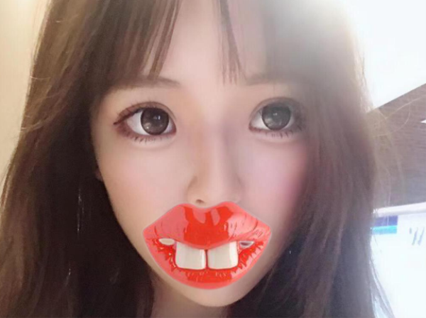 求助！這是我做全切雙眼皮四個月的恢復(fù)圖會不會太窄了？
