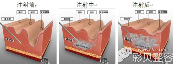 王祥醫(yī)生做面部除皺怎么樣 王祥醫(yī)生做面部除皺怎么樣