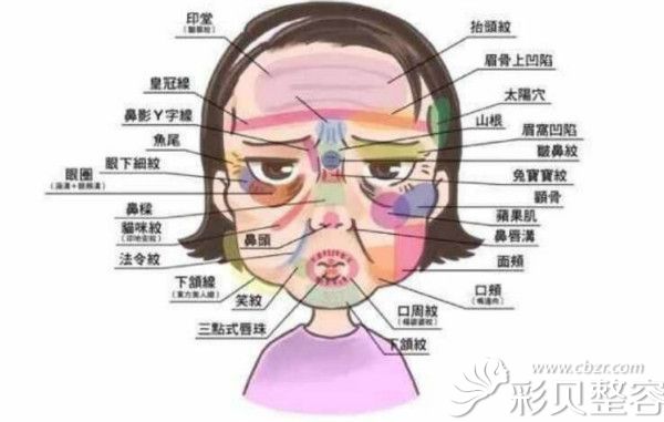 臉上的皺紋示意圖