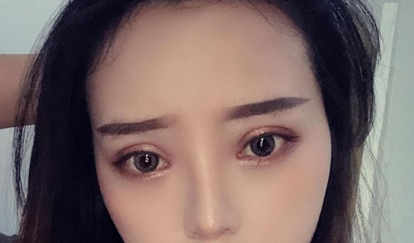 自從做了雙眼皮加開眼角,終于知道為啥好看的人內(nèi)眼角都尖