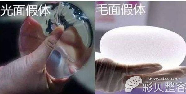 光面假體與毛面假體區(qū)別 光面假體與毛面假體區(qū)別