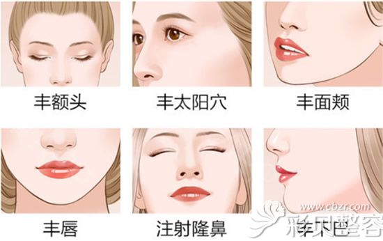 玻尿酸適合填充部位圖
