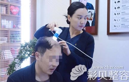 植發(fā)前先做毛囊檢測