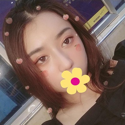 我的半肋骨加膨體隆鼻經(jīng)歷：手術(shù)花了4萬(wàn)元這有前后對(duì)比圖