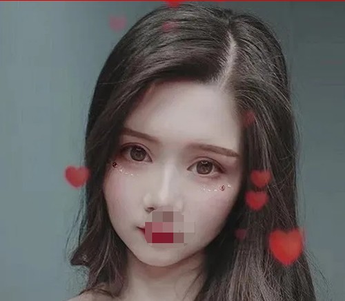 15000元做的眼綜合20天恢復(fù)圖,看我怎么從母胎單眼皮成功脫單