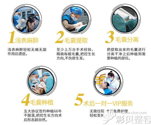 成都恒美植發(fā)技術(shù)優(yōu)勢(shì)