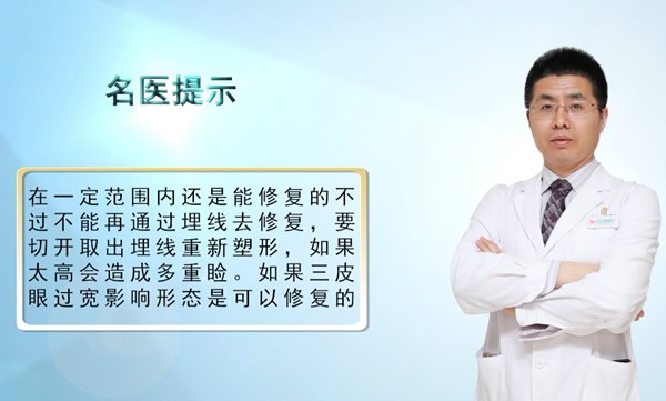 埋線雙眼皮過寬怎么修復(fù)?合肥華美朱德剛建議先拆線再全切!