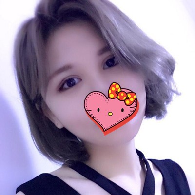 我在吉林中妍整形將面部吸脂和雙眼皮一起做,恢復(fù)后特別美