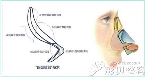 四弧雕刻技術(shù) 四弧雕刻技術(shù)