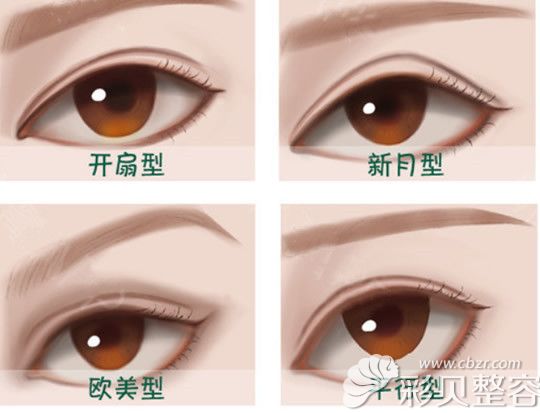 雙眼皮有幾種款式 雙眼皮有幾種款式