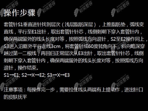 悅升線提升蘋果肌操作步驟
