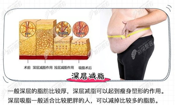 水動力深層減脂 水動力深層減脂