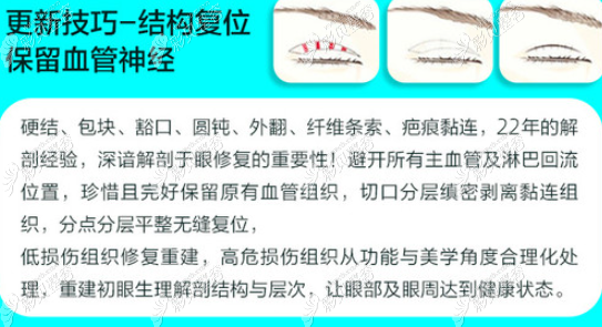 廈門歐菲袁純新雙眼皮修復(fù)手法