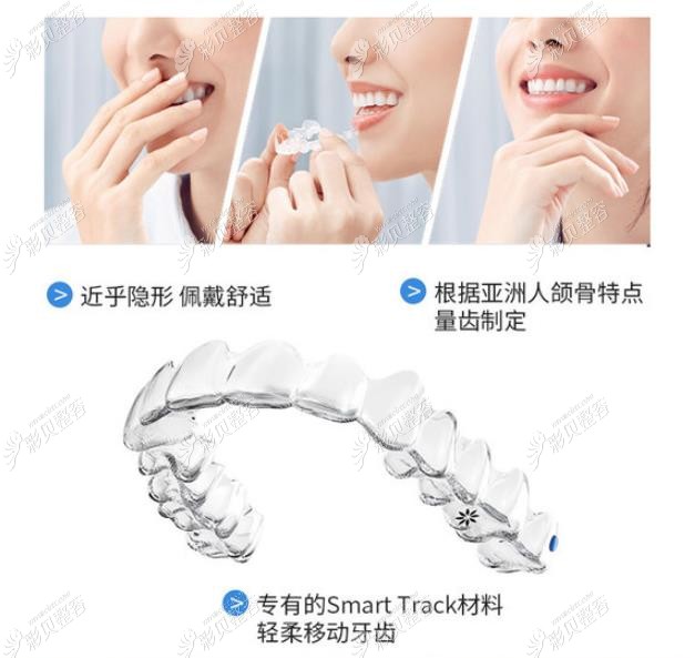 隱適美矯正的優(yōu)勢